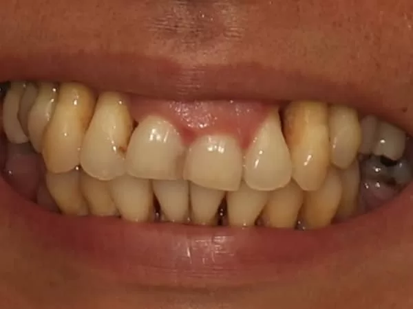 Chapel hill oral surgery
