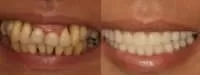 Chapel hill oral surgery